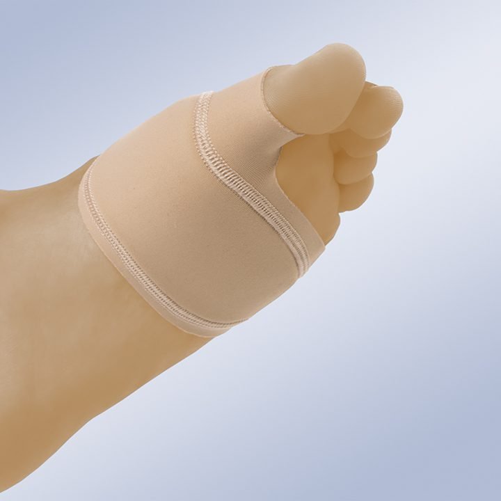 Joanete, Hallux Valgus